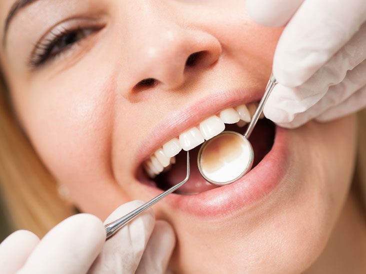 What is Deep Teeth Cleaning, Types and Benefits Art of Smiles